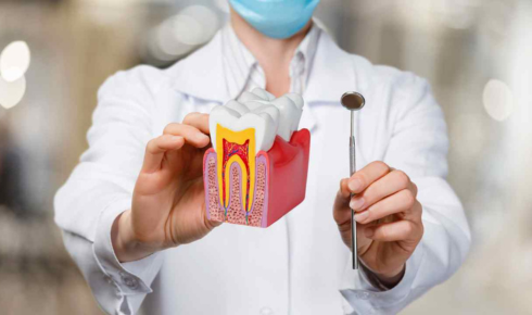 Dental Implants vs Dentures Long-Term Comfort, Cost and Care Comparison