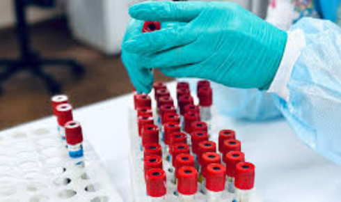 Fatty Liver Basics Test Report Me “Grade 1” Likha Ho To Kya Matlb Hota Hai