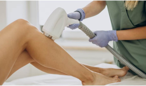 Laser Hair Removal Kitne Sessions, Kitna Safe Aur Kaun Log Avoid Karein